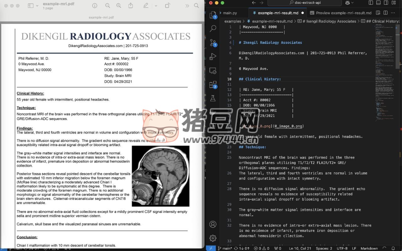 pdf-extract-api：高精度文檔解析和提取 API 開源項目